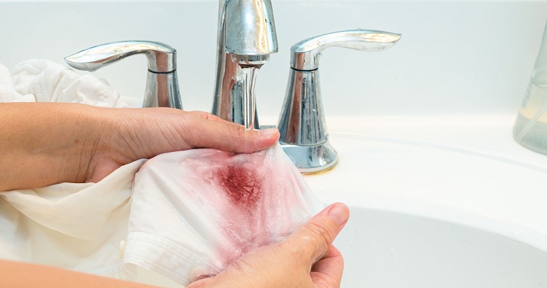 طريقة أزالة بقع الدم طريقة أزالة بقع الدم