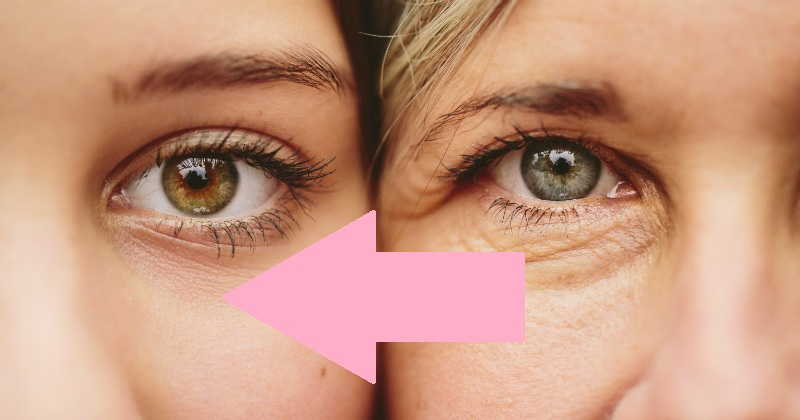 هذه الاخطاء تعجل من ظهور تجاعيد العين هذه الاخطاء تعجل من ظهور تجاعيد العين