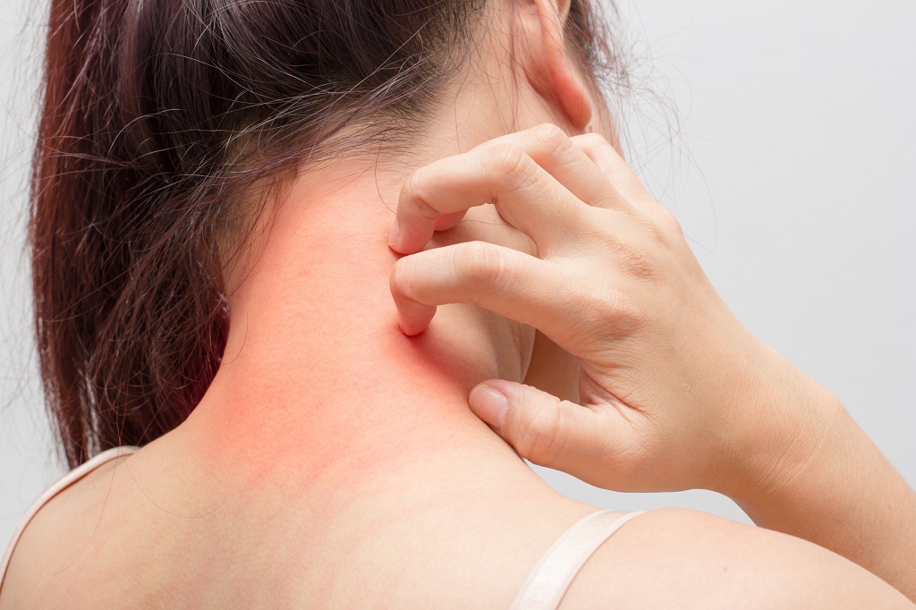 4 مكونات طبيعية تساعدك على التخلص من الناموس نهائيا 4 مكونات طبيعية تساعدك على القضاء على الناموس نهائيا