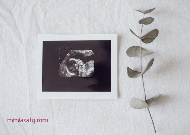 اسماء-منشطات-للحمل اسماء منشطات للحمل حبوب كلوميد لتنشيط المبيضين يعد الكلوميد هو الأشهر على الإطلاق والأكثر شيوعاً بين السيدات، وحقق هذا العلاج نجاحاً كبيراً على الكثير من السيدات