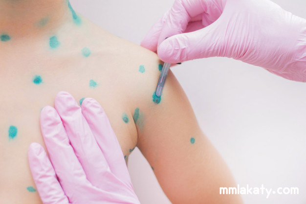 أعراض الجدري عند الأطفال