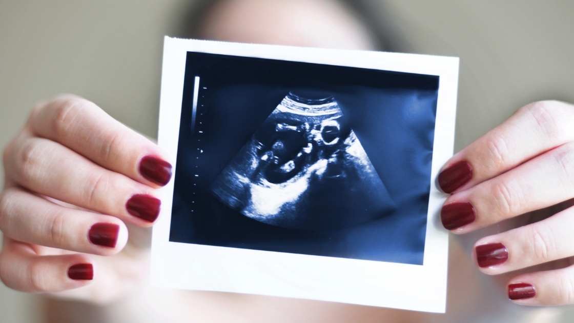 كيس الحمل في السونار متى يظهر كيس الحمل