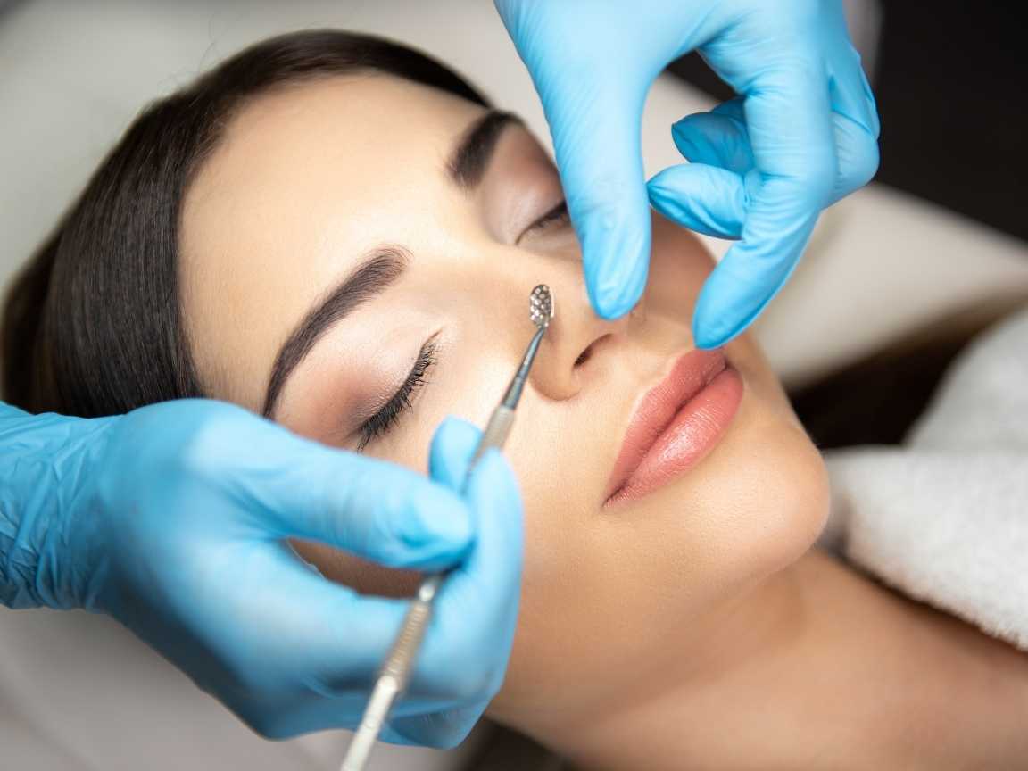 الرؤوس السوداء (3) ماسك للرؤوس السوداء