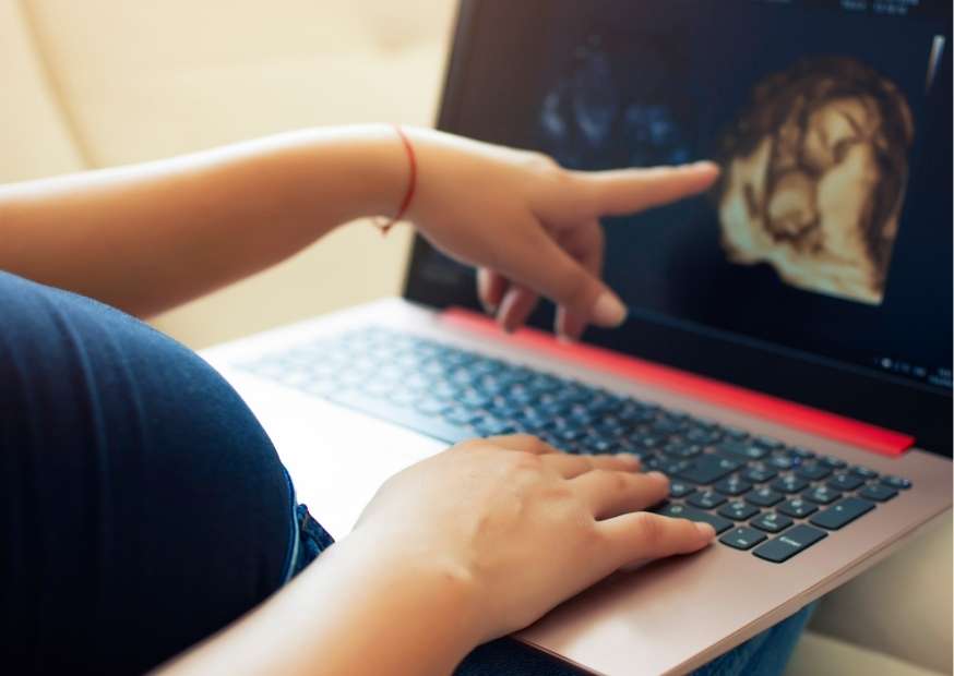 مكان الجنين في الشهر الثالث في البطن