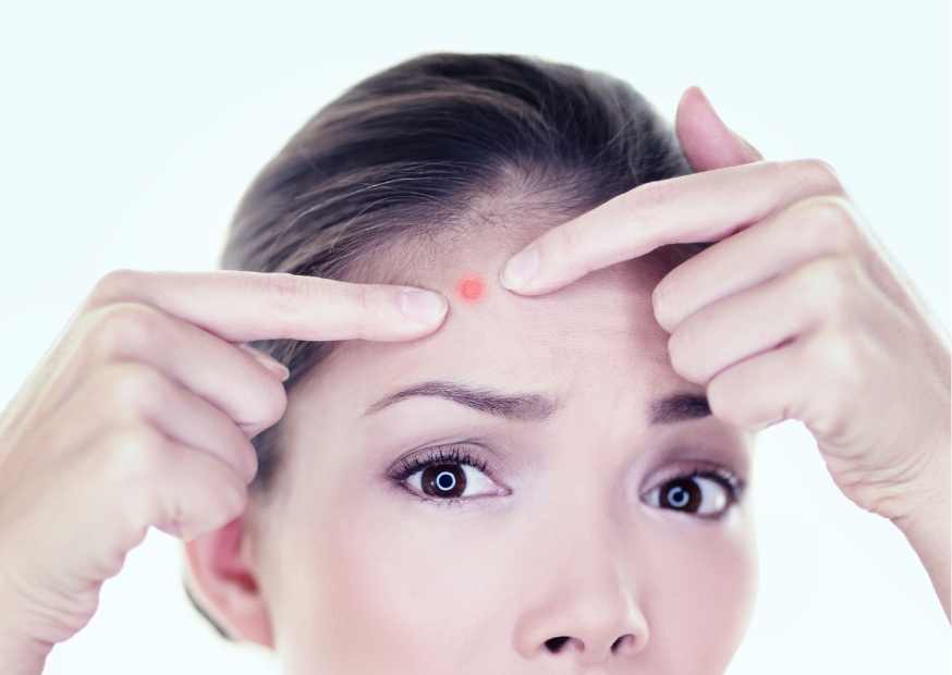 ماسك للحبوب الحمراء ماسك للحبوب الملتهبة الحمراء