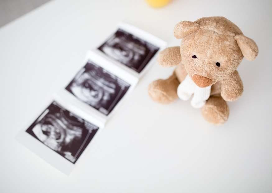 حامل ولم يظهر كيس الحمل