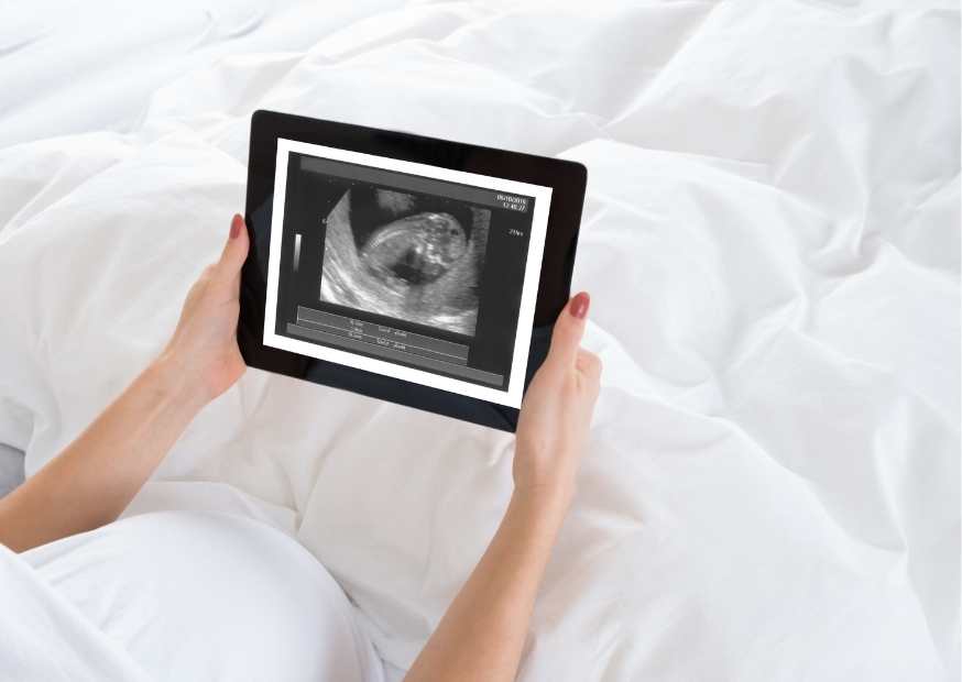 متى يظهر الحمل الضعيف في السونار