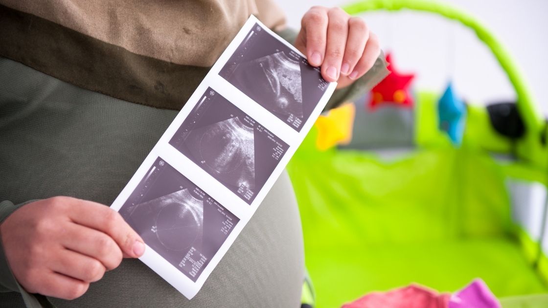 الحمل المتأخر والتحليل الهرموني