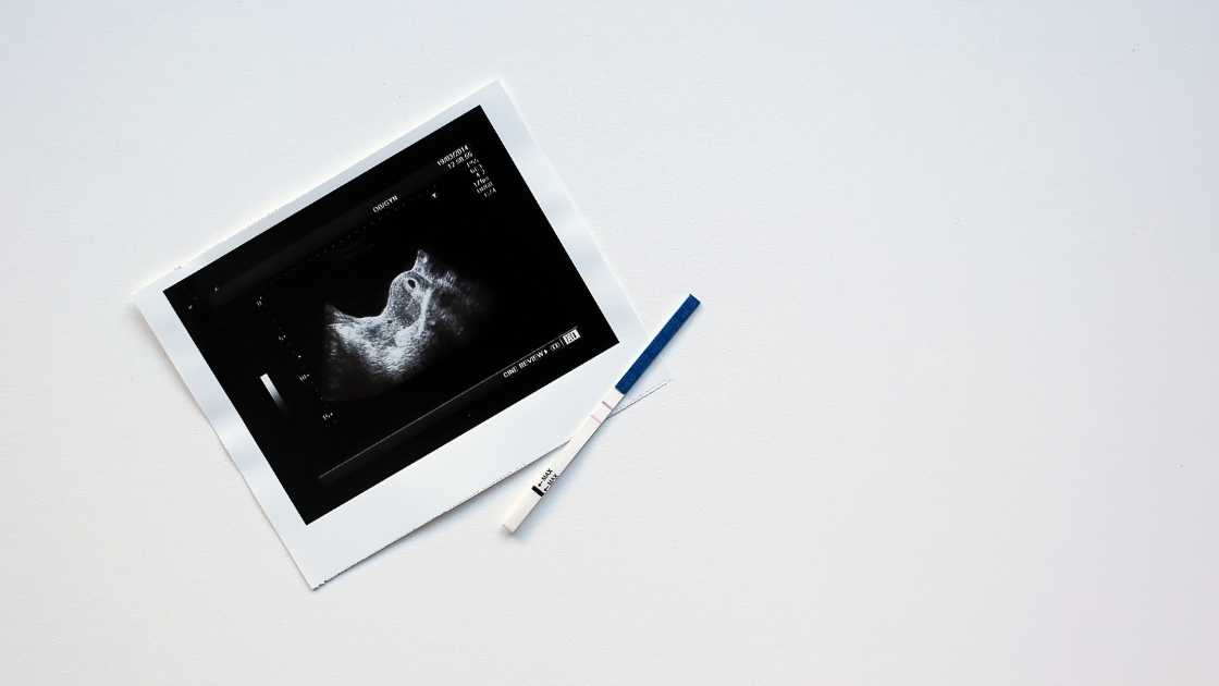 شكل الجنين في الشهر الأول شكل الجنين في الشهر الأول