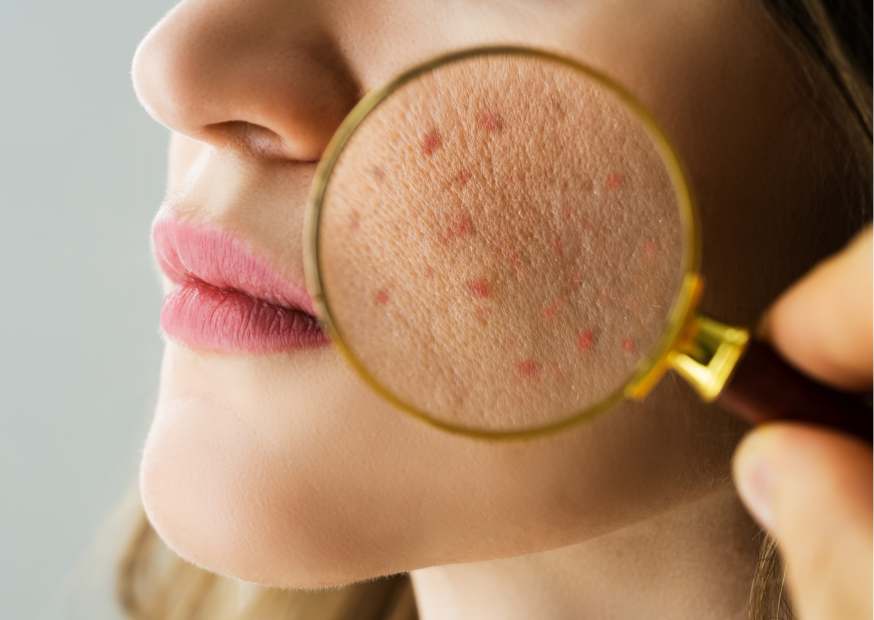 توحيد لون الجسم