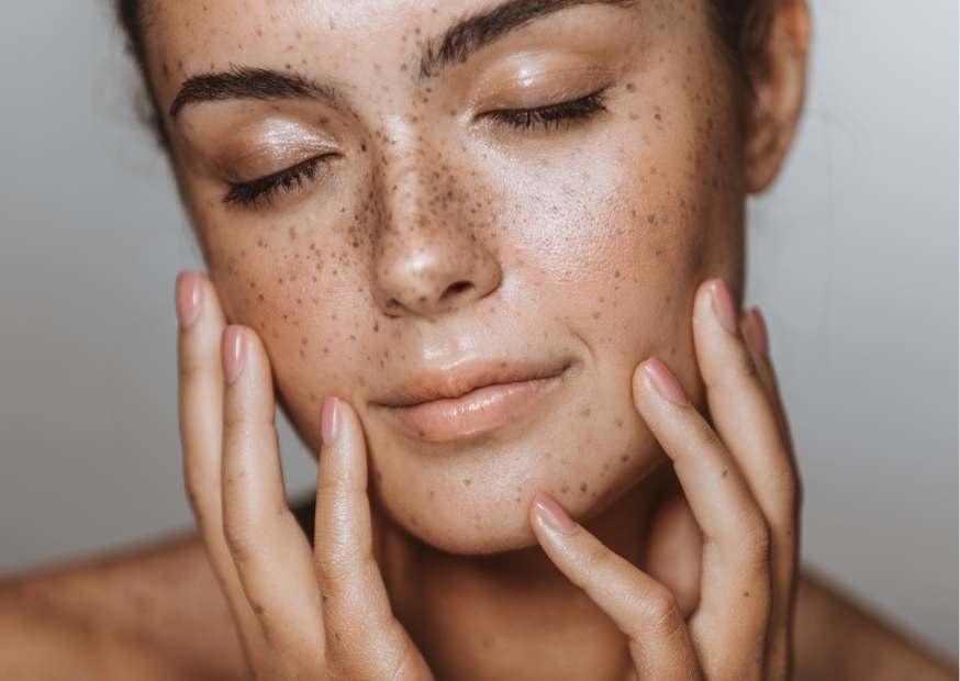 كريم للتصبغات كريم للتصبغات