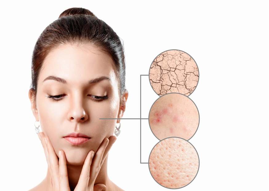 كريم مبيض للوجه