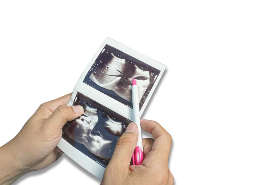 أفضل مشروب للتخسيس أثناء الحمل أفضل مشروب للتخسيس أثناء الحمل