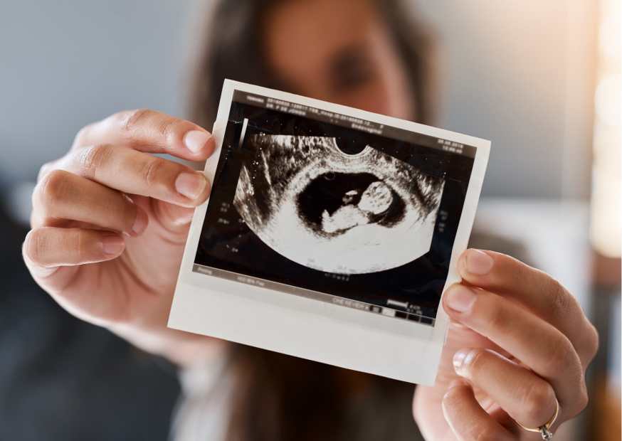 هل تشوهات الجنين تظهر في السونار هل تشوهات الجنين تظهر في السونار