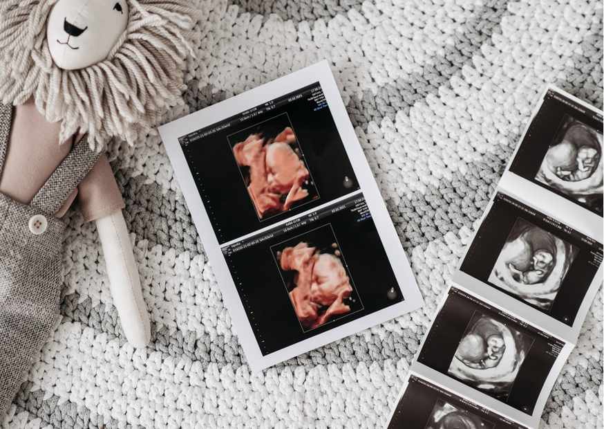 أعراض هبوط الضغط للحامل