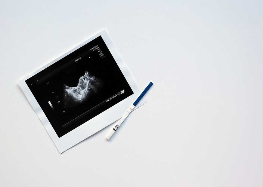 متابعة الحمل بعد الحقن المجهري متابعة الحمل بعد الحقن المجهري