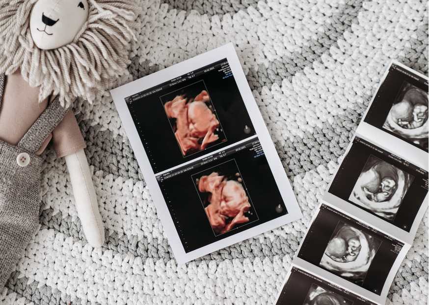 هل الحمل بعد الدورة مباشرة يكون ولد؟ هل الحمل بعد الدورة مباشرة يكون ولد؟