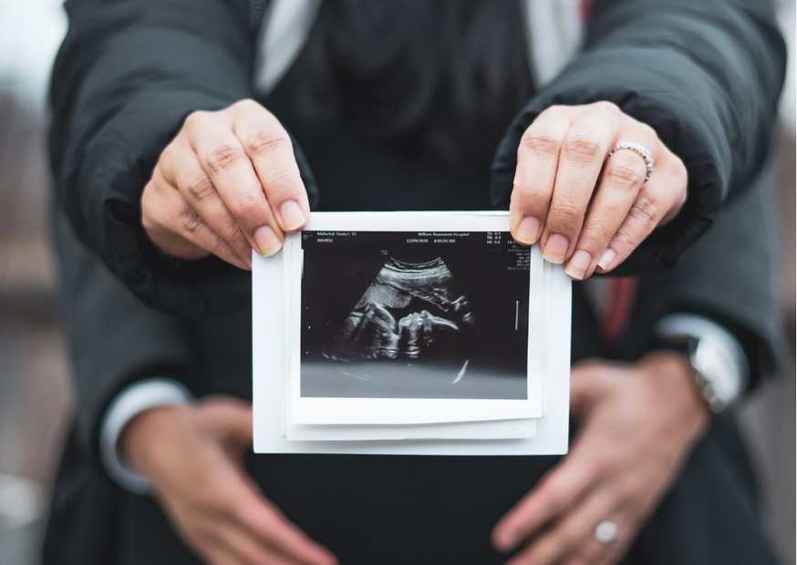 نصائح للحامل في الشهر الأول لتثبيت الحمل