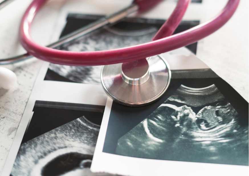 متى يتم تحديد نوع الجنين