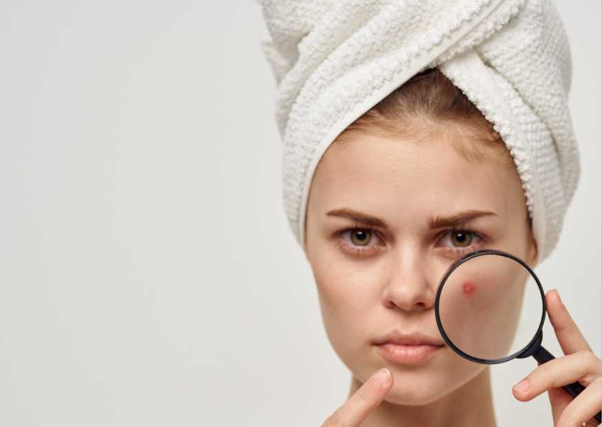 متى تظهر نتائج حبوب الروكتان متى تظهر نتائج حبوب الروكتان