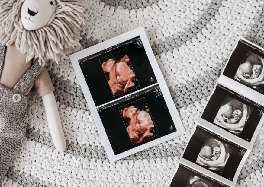 كيف أحسب عدد أسابيع الحمل