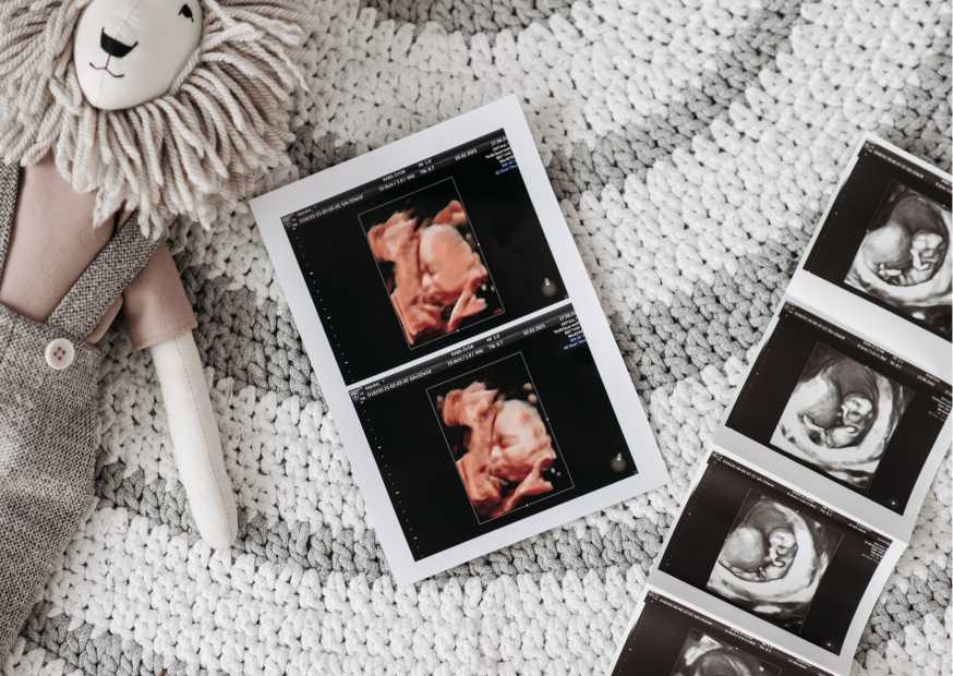 هل زيادة الشهية من علامات الحمل المبكرة