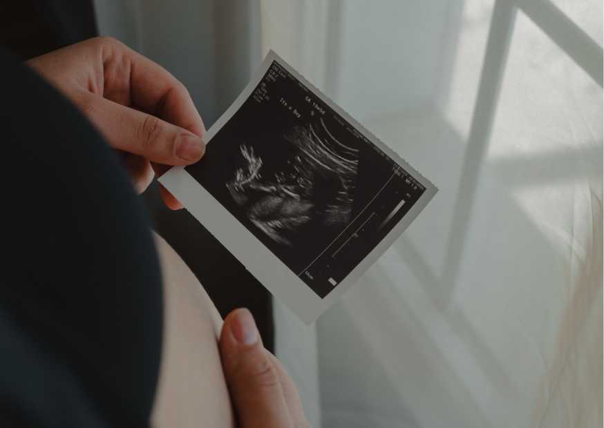 الجنين مسكر رجوله بالشهر الرابع الجنين مسكر رجوله بالشهر الرابع