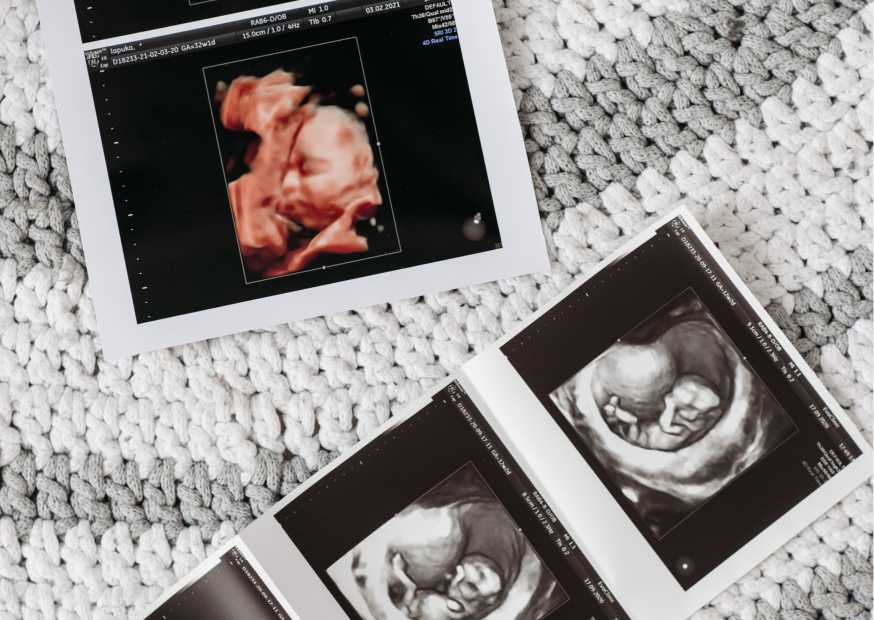 كيف اعرف اني حامل في أول أسبوعين كيف اعرف اني حامل في أول أسبوعين