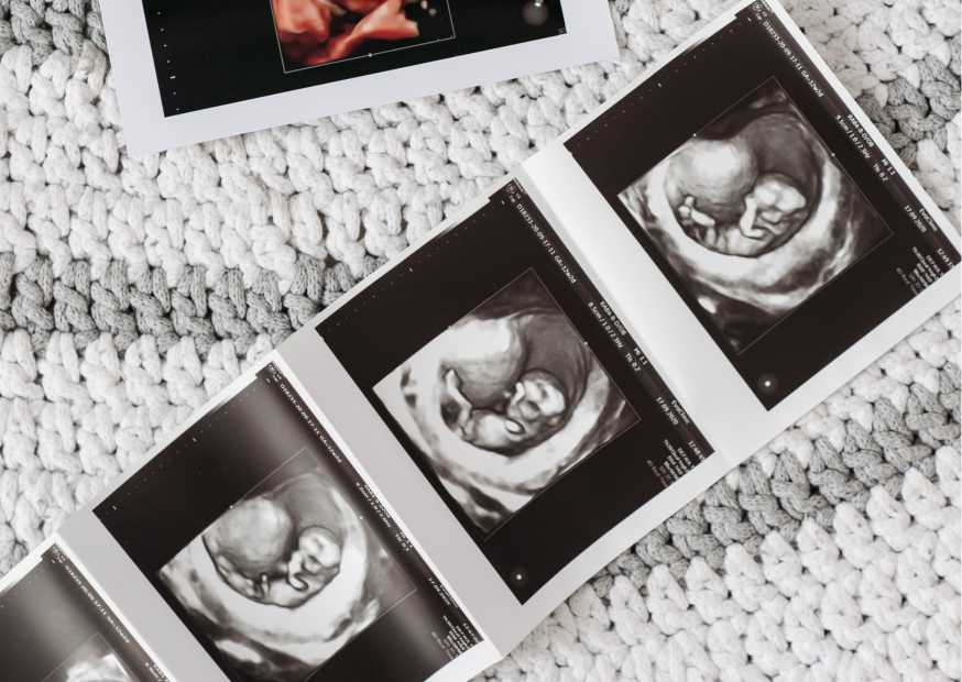 هل يستطيع الطبيب معرفة الحمل في الأسبوع الأول هل يستطيع الطبيب معرفة الحمل في الأسبوع الأول